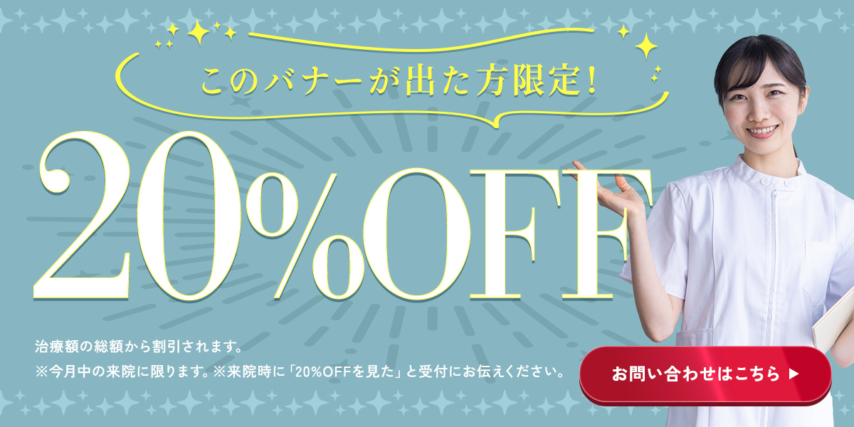 20%OFF