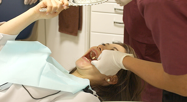 1回目の治療：銀歯を外した後、出来上がってくるセラミックの色を決める様子