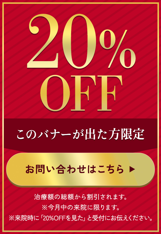 20%OFF