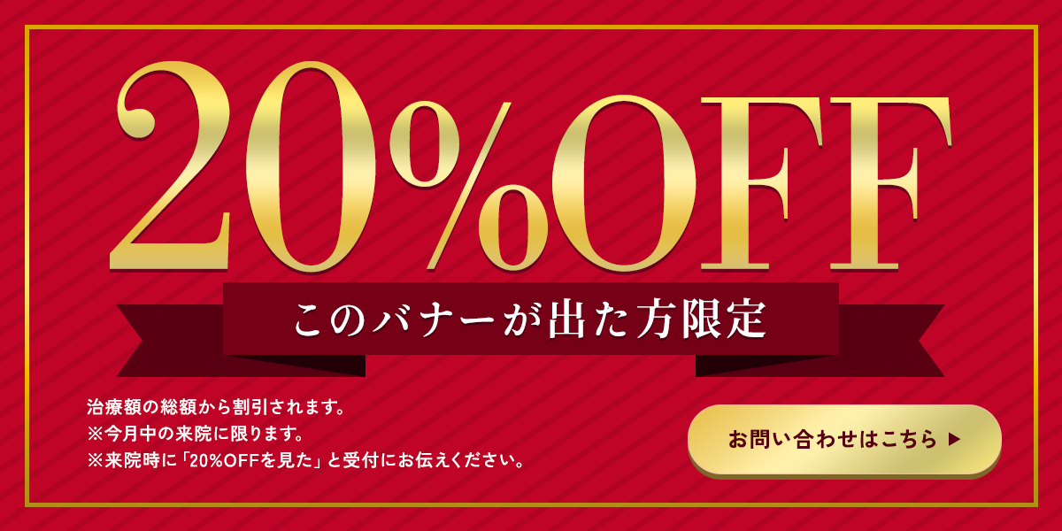 20%OFF