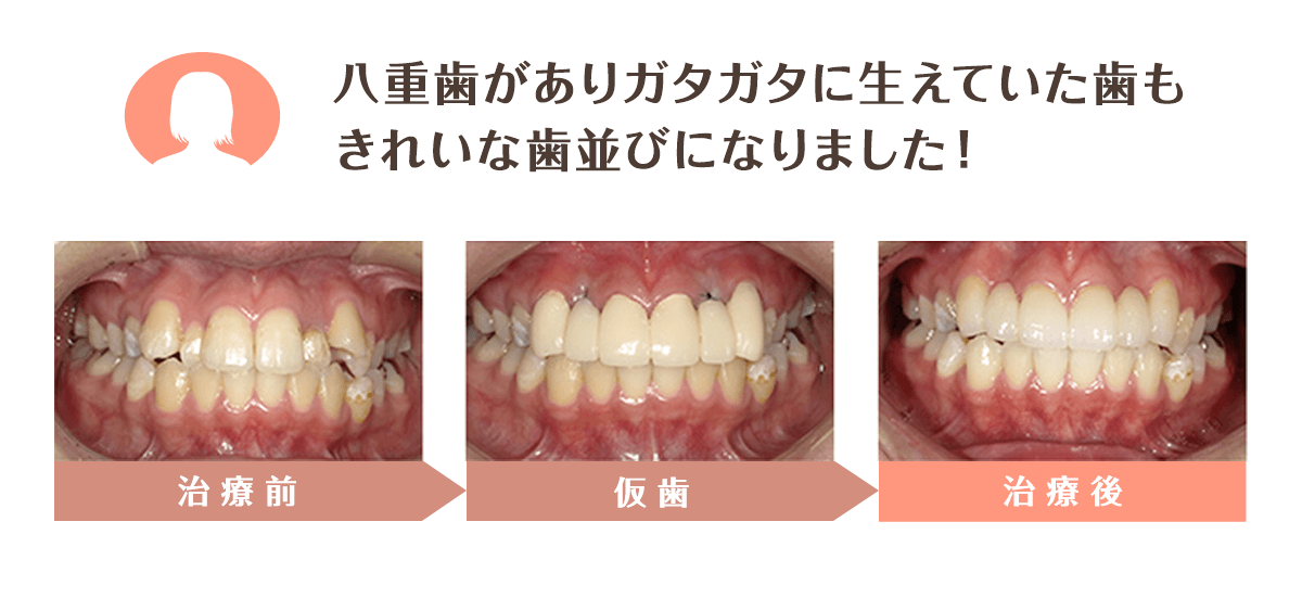 白く美しい見た目が劣化せず持続する