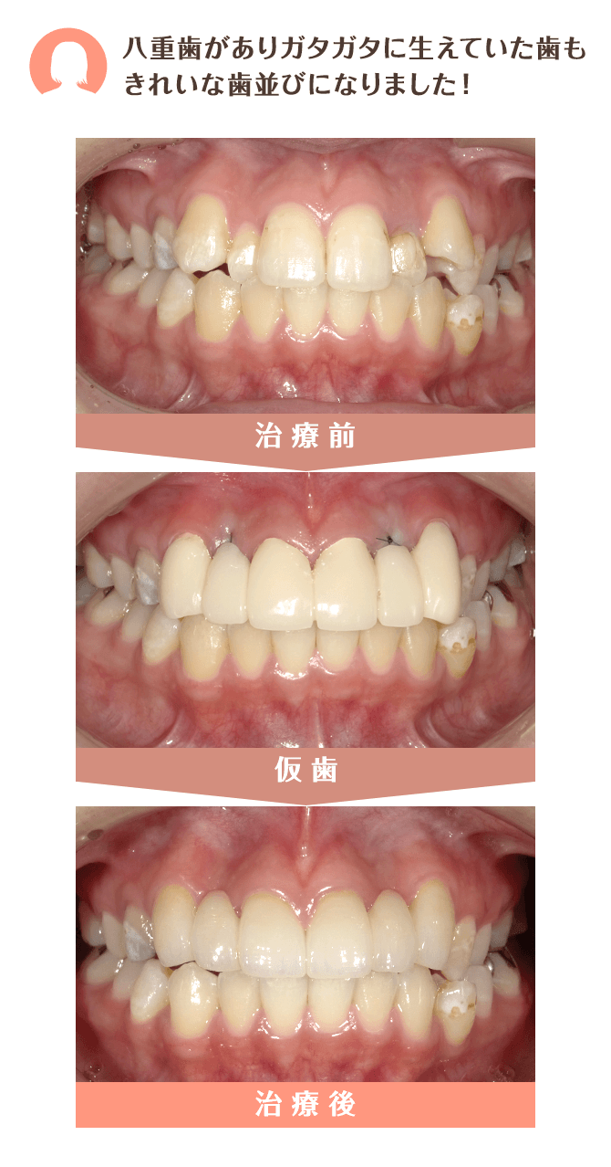 白く美しい見た目が劣化せず持続する