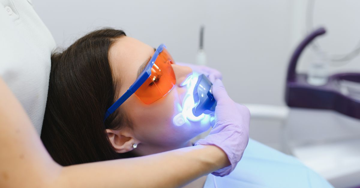 ホワイトニングとの違い