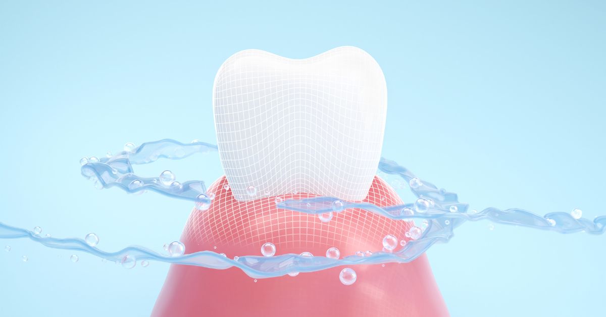 ラミネートベニアに関するよくある質問（Q&A）