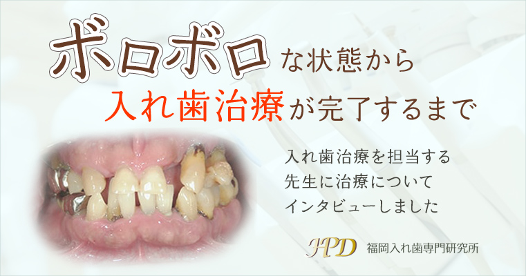 ボロボロな状態から入れ歯治療が完了するまで